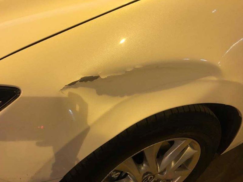 Bảo hiểm thân vỏ xe Hyundai Accent